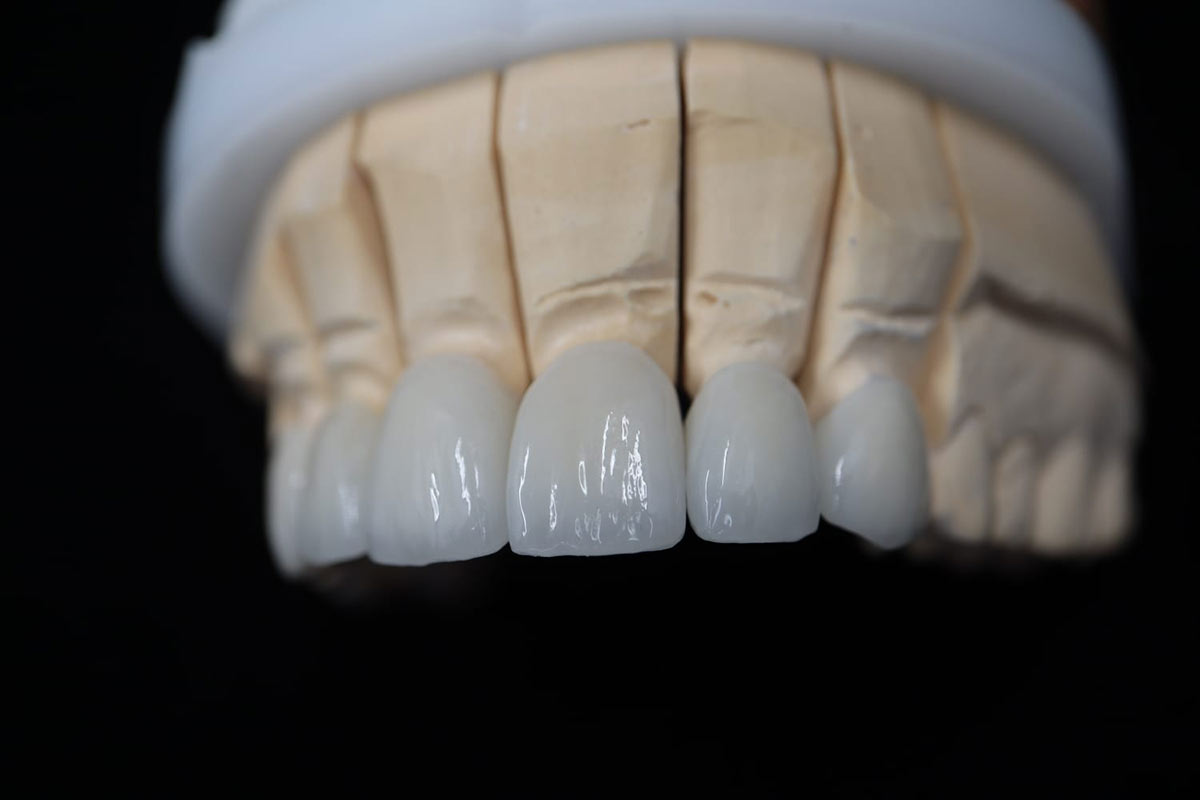 Dentallabor &amp; Fräszentrum Frankfurt Neu-Isenburg Ö.Sz.L. Zahntechnik